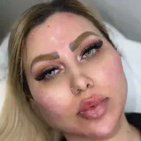 فیلر لب و بوتاکس و مزو صورت