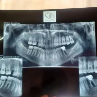 آموزش دستیاری دندانپزشکی