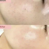 آموزش تخصصی فیشیال و پاکسازی با مدرک فنی حرفه‌ای