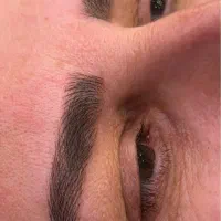 میکروبلیدینگ ، فیبروز فقط هزینه مواد ۹۰۰تومن