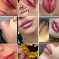 انجام خدمات ژل بوتاکس پیرسینگ میکروبلیدینگ شیدینگ