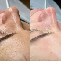 پاکسازی پوست