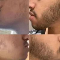 هرشب بزن ریشات در بیاد