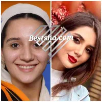 جراحی زیبایی بینی لیپوساکشن ابدو لیفت پیکرتراشی