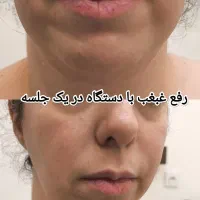راحت ترین روش لاغری توسط متخصص لاغری