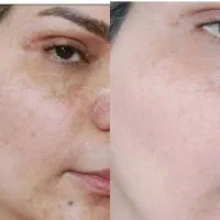 رفع تمام مشکلات پوستی