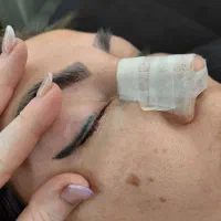 پاک کردن تخصصی تتو