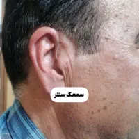 سمعک سنتر افسریه (اقساط)