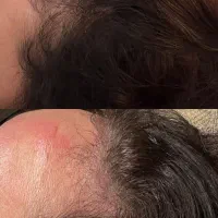 فرمول رویش طبیعی موهات اینجاست