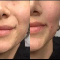 تکنسین زیبایی آماده همکاری با مطب یا کلینیک زیبایی