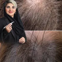 می‌خوای از شر تاپیک برای همیشه خلاص شی