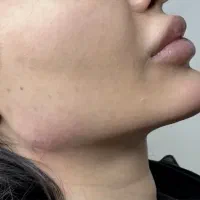 پکیج مادلینگ ومیدفیس بمدت۷۲ساعت فقط و فقط۴۸۹۰|خدمات آرایشگری و زیبایی|تهران, ستارخان|دیوار