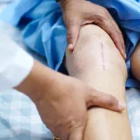 درمان مفاصل بدون عمل هزینه کم جواب دهی سریع