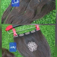 شپش موی سر