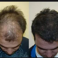 ریشت خالیه شاید هنوز روش درست را امتحان نکردی