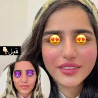 خدمات زیبای ژل و‌بوتاکس برای خانمهاواقایون۹۵۰