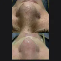 پاکسازی عمیق پوست، برداشتن خال زگیل، رنگ مو