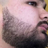 صورتت مُکت میشه اگر