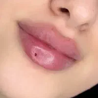 تجربه چهره ای زیباتر با تزریق فیلر