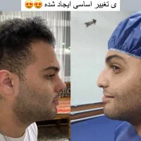 جراحی بینی توسط دکتر امیر حسین اسدالله پور
