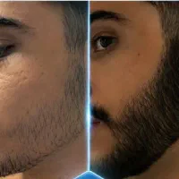 افزایش ریش و مو در یک ماه