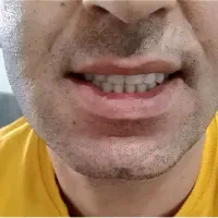خدمات دندانسازی
