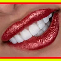 دندانپزشکی عصبکشی/کامپوزیت/پالیش/ترمیم/شرق و غرب