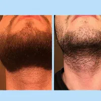 مرد شو|آرایشی، بهداشتی، درمانی|تویسرکان, |دیوار
