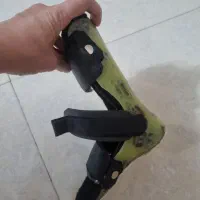 آتل پای کودک