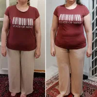 موثرین روش لاغری با یک جلسه هدیه با کرایولیپولیز