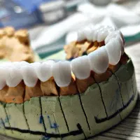 لابراتوار دندانسازی (ساخت روکش ثابت)