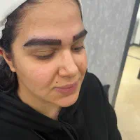 کاشت ابرو وی ای و سر و شقیقه تمام اقساط