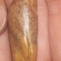 عرج سویحلی