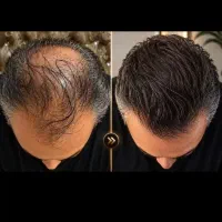 خداحافظی باریش کم پشت