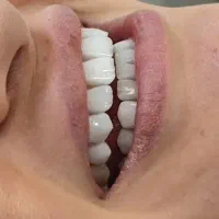 دندانپزشکی با آفر های ویژه