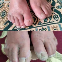 بدنت رو ری استارت کن (درمان آرتروز و دیابت..)