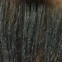 پاکسازی شپش در یک جلسه به صورت حضوری در مرکز