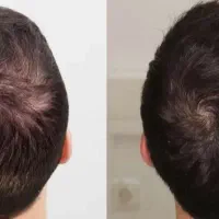 این آخرین اقدامه
