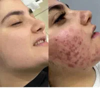 جشنواره ی  تضمینی لک و جوش