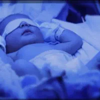 اجاره دستگاه رفع زردی نوزاد فتوتراپی