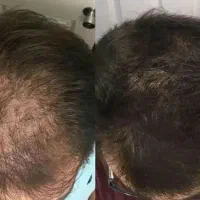 کمک میکنم از افسردگی در بیای