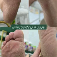 کفسابی تخصصی و پدیکور درمانی
