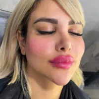 تخفیف ویژه لیزر موهای زائد