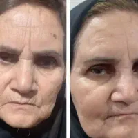 با روزی ۲تومن پوستتو لیفت و صاف کن