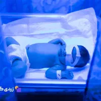 اجاره ی دستگاه‌ زردی نوزاد (فتوتراپی)۶۰۰هزارتومان|خدمات زیبایی و سلامت|کرج, گلشهر|دیوار
