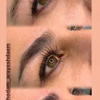 یک ابروی طبیعی ونچرال برای فیبروز ابرپ