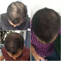 بهترین و قوی ترین ترفند رشد ریشه