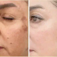 معجزه کرم تایلندی ما ضمانتی گیاهی صدرصد