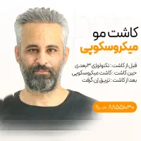 کاشت vip بصورت اقساطی