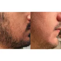 کاملا طبیعی درمان شو